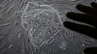 The outline of a hand reaches toward an embryo under a microscope.