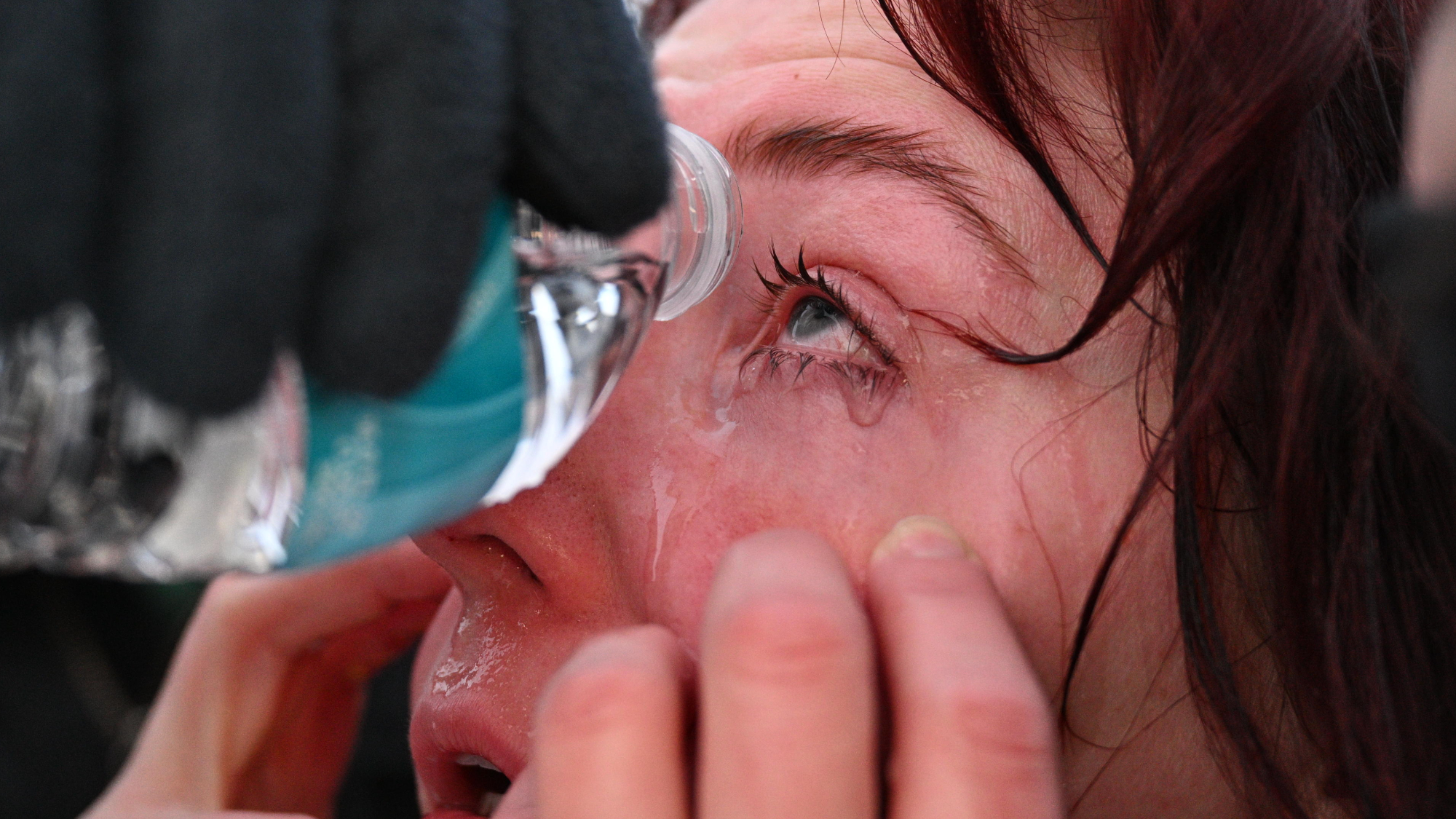 A white protester has water poured over their eyes. 