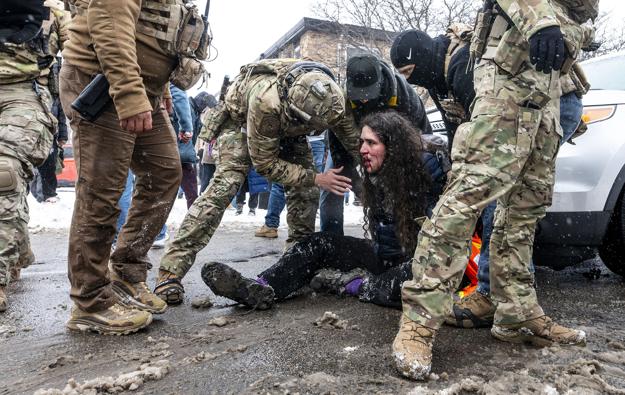 A man with a bloodied face sits on the ground surrounded by men in camo.