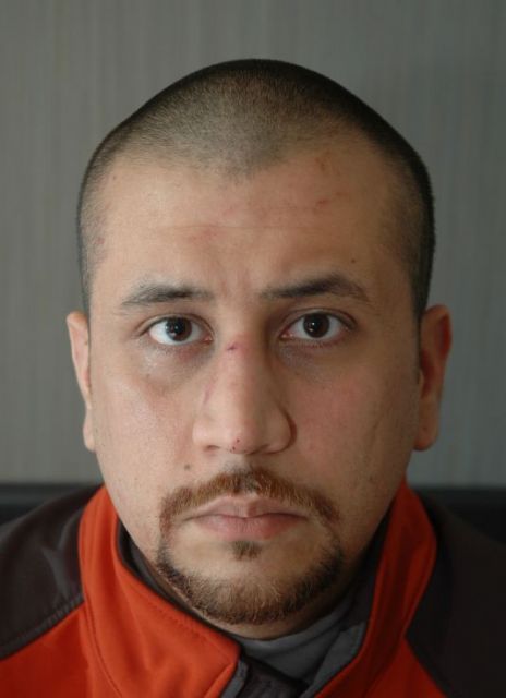 Photo of George Zimmerman after the shooting: State of Florida