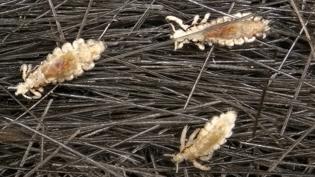 Lice Ladies Reveal Their Itchy Little Secrets – Mother Jones