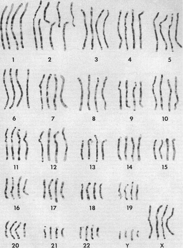 Side-by-side comparison of the chromosomes of humans, chimpanzees, gorillas, and orangutans (from left to right for each chromosome)